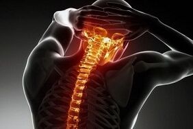 Douleur associée à l'ostéochondrose