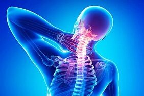 Le mal de dos comme symptôme de l'ostéochondrose