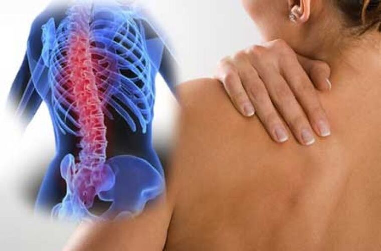 Avec une exacerbation de l'ostéochondrose de la colonne thoracique, une douleur dorsale survient