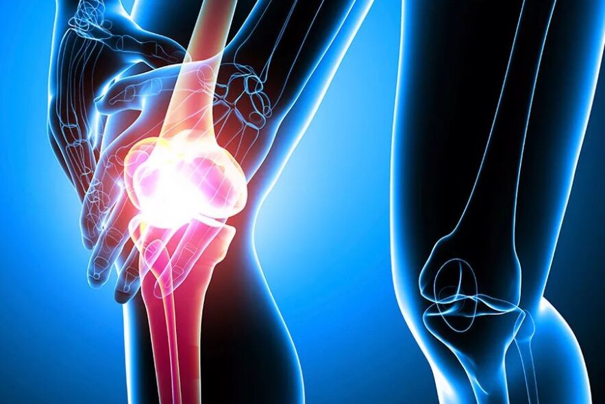 Arthrose du genou