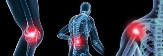Types de douleur avec arthrose