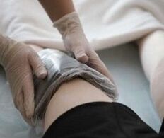 Applications d'ozokérite sur le genou pour l'arthrose