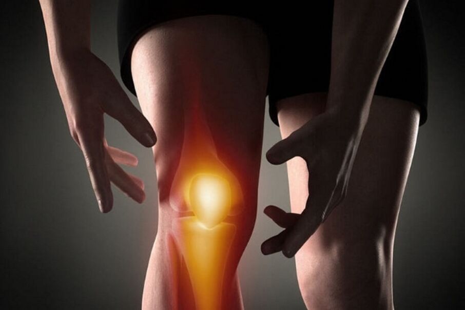 Dans l'arthrose, la douleur augmente avec le mouvement